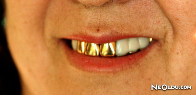 Rüyada Altın Diş Görmek Ne Anlama Gelir? amaçlanan Rüyada Dudaktan Öpülmek Ne Anlama Gelir