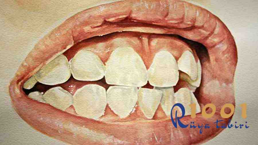 Rüyada Diş Görmek, Rüyada Diş Kırılması, Diş Çıkması 1001Ruyatabiri amaçlanan Rüyada Beyaz Diş Görmek